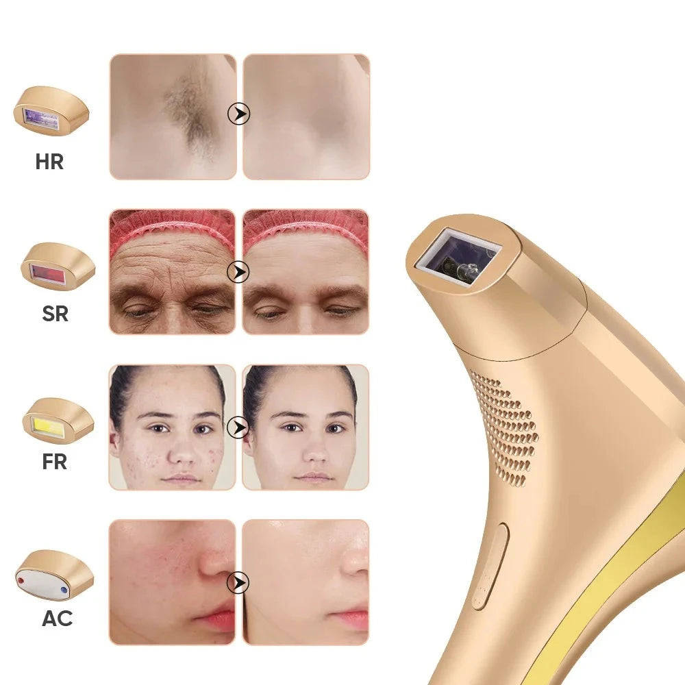 2024 High-end customization ice Laser Hair removal